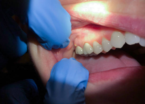 Best Emergency Cosmetic Dentistry (e.g., broken veneers) in Salida Del Sol Estates, TX