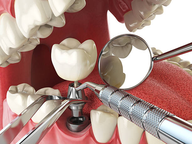 Best Emergency Dental Care for Sports Injuries in Salida Del Sol Estates, TX